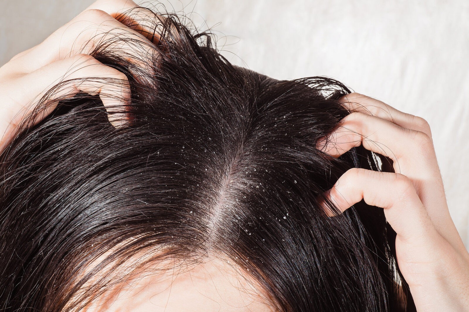 5 причин ополаскивать волосы уксусом: советует врач-трихолог!